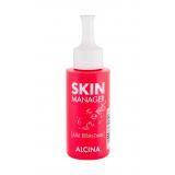 ALCINA Skin Manager AHA Effekt Tonic Arclemosó nőknek 50 ml